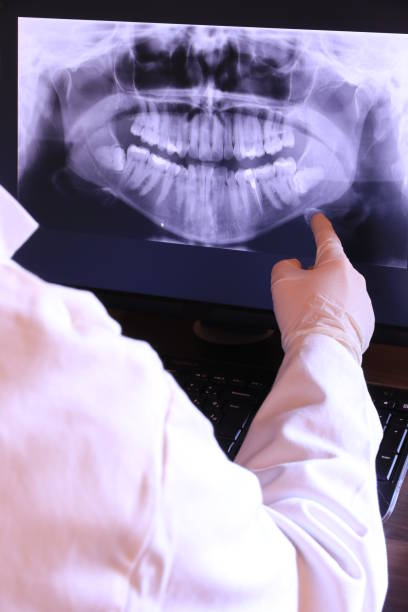 Best Emergency Root Canal Treatment in Belleville, MI
